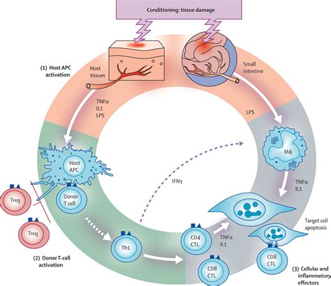 Graft Versus Host Disease The Lancet