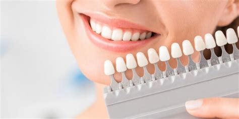 A Guide To Different Cosmetic Dentistry Procedures Daily Nutrition News