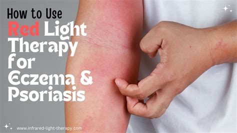 How To Use Red Light Therapy For Eczema And Psoriasis At Home
