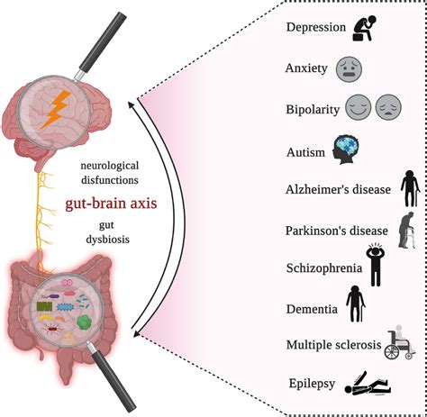 Frontiers Guts Imbalance Imbalances The Brain A Review Of Gut