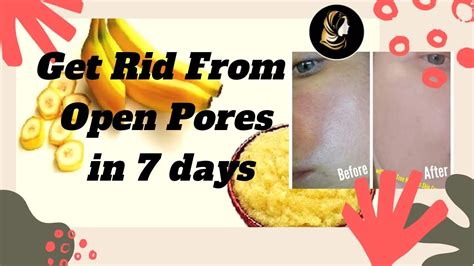 How To Minimise Pores How To Shrink Open Pores In 7 Days With 100