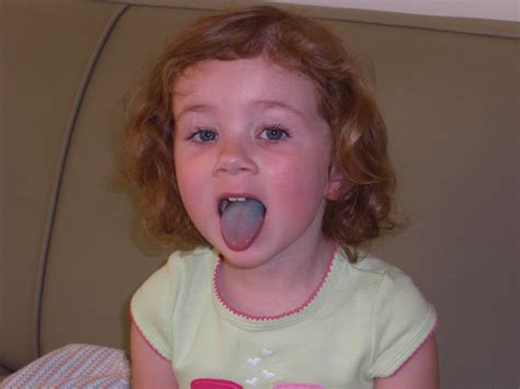 Blue Tongue The Wesslers