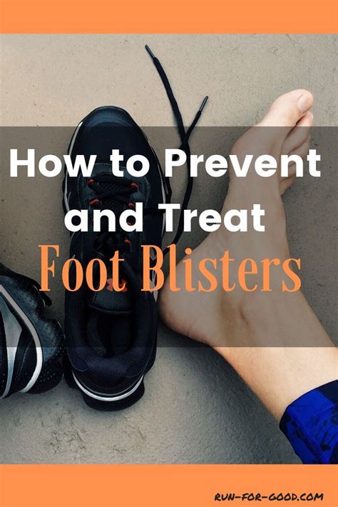 How To Prevent And Treat Foot Blisters Run For Good Running Blisters Running Injuries