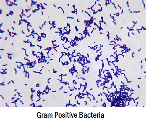 The gram stain result becomes variable as the culture ages. Differences Between Gram Positive and Gram Negative ...