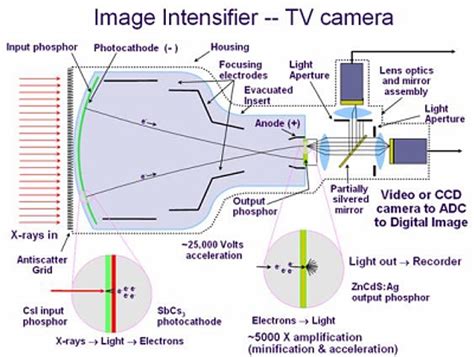 The Image Intensifier Ii Radiology Suny Upstate