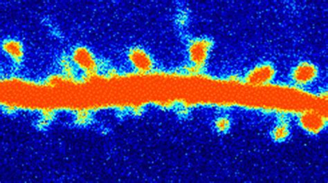 Ketamine Relieves Depression By Restoring Brain Connections Shots