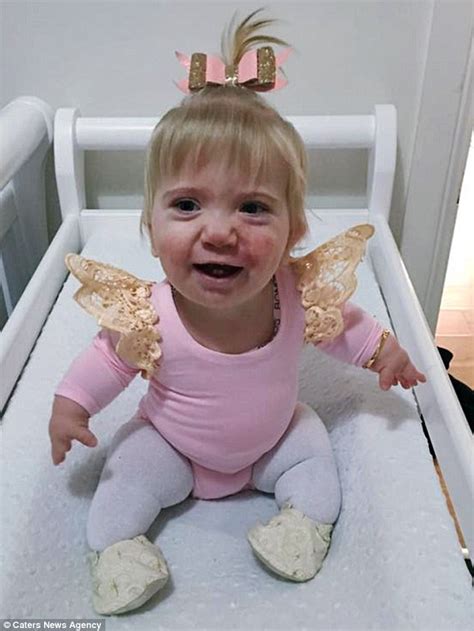Sydney Miracle Baby Helena Lang With Rare Form Of Dwarfism Reaches Her