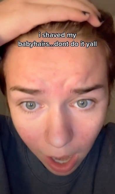 Details More Than Baby Hair Forehead Grow In Eteachers