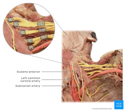 Brachial Plexus Injury Clinical Case Anatomy Symptoms