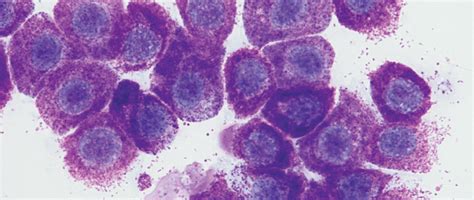 Cytologic Grading Of Mast Cell Tumors In Small Animals