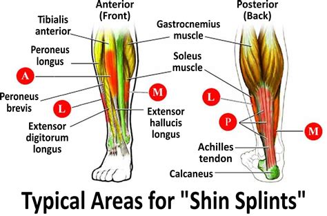 Shin Splints Are Common In People Who Do A Lot Of Springing On The