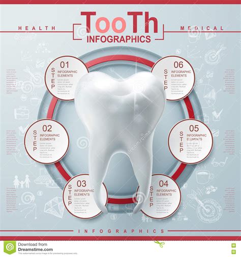 Infographic Dental Implant Structure Info Poster Cartoon Vector
