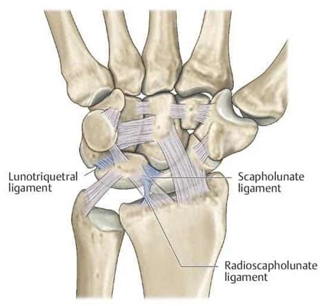 How To Treat A Sprained Wrist Precision Movement