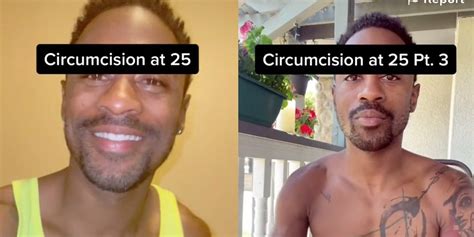 A 25 Year Old Got Circumcised After Phimosis Diagnosis Foreskin Pain