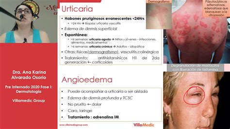 Dermatolog A Urticaria Y Angioedema Youtube
