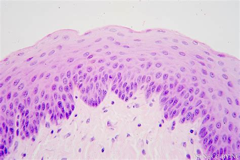 Nonkeratinized Stratified Squamous Epithelium Function And Structure