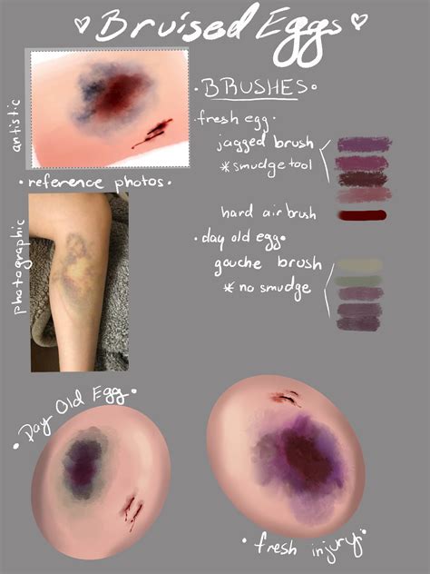 Https://tommynaija.com/draw/how To Draw A Bruise