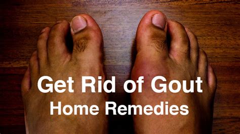 8 Gout Home Remedies But Only 1 Works Well Kidney Atlas