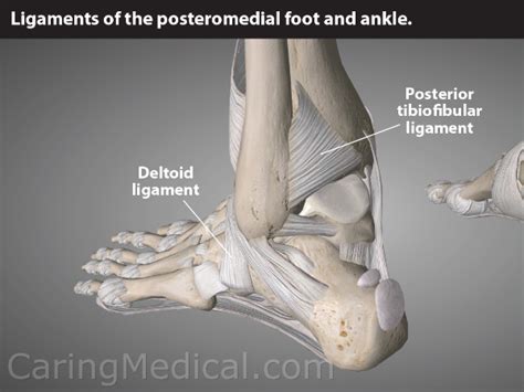 Does Ankle Impingement Require Surgery Improving Range Of Motion