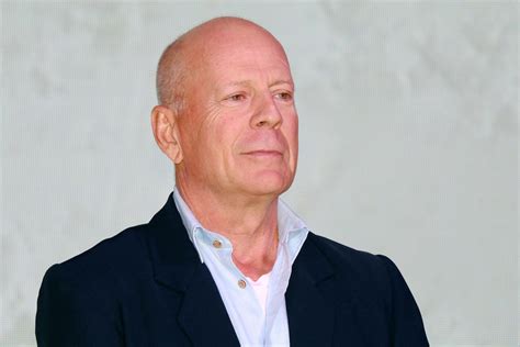 Bruce Willis Diagnosed With Frontotemporal Dementia