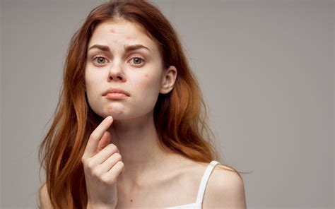 16 Effective Skin Care Tips For Teenagers Skinkraft
