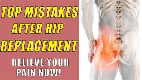 Top Mistakes After Hip Replacement Youtube