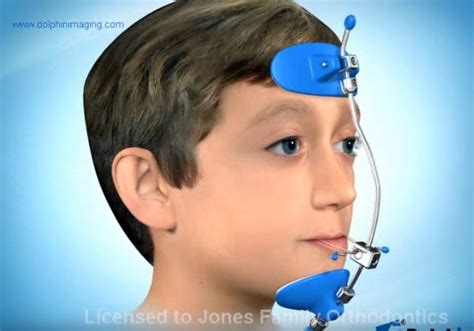 Orthodontiste, chirurgien dentiste qualifié en orthopédie dentofaciale. masquefacial - Orthodontiste Le Mans