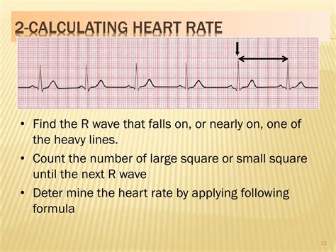 How To Calculate Heart Rate Through Ecg Haiper