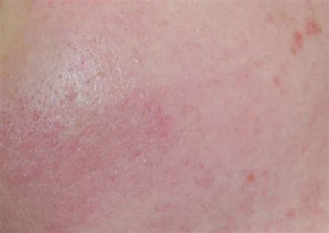 Active Serum