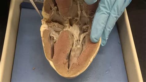 Cardiovascular System Part 3a Heart Dissection Youtube