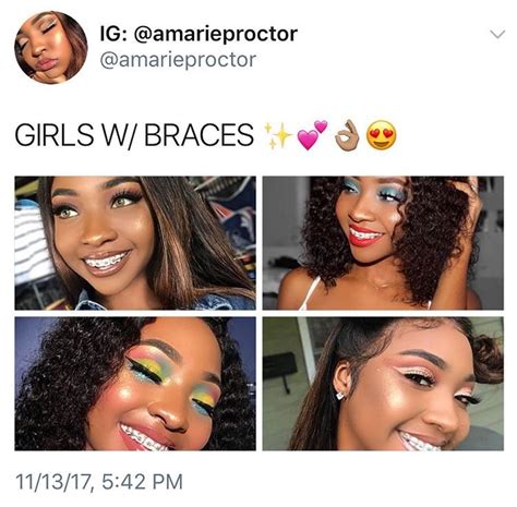 Pin By Xpterwolf Gamer On Smile Braces Colors Brace Face Cute Braces
