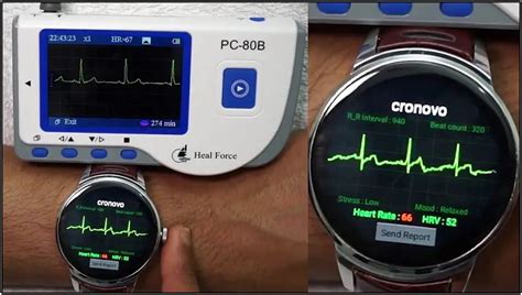 15 Best Ecg Smartwatches To Measure Irregular Heart Rate Rhythm