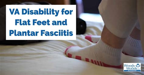How The Va Ratings For Plantar Fasciitis And Flat Feet Work