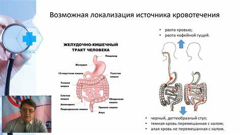 Диета желудочно кишечного кровотечения Желудочно кишечные кровотечения Тактика больного - YouTube Желудочно кишечные кровотечения Тактика больного - YouTube Диета желудочно кишечного кровотечения