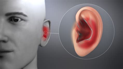 Ear Infection Symptoms Causes And Treatment Scientific Animations