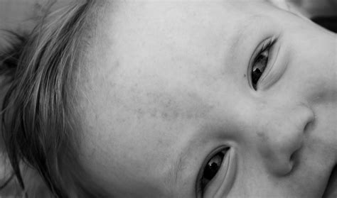 After i did some research, i found the name angel kiss. through mommy goggles: angel kiss