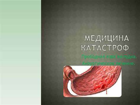 Прободная язва желудка диета Прободная язва желудка Хирургическое лечение 1 2 Прободная язва желудка Хирургическое лечение 1 2 Прободная язва желудка диета
