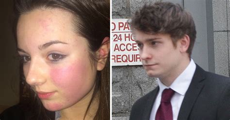 Selfie Shows Bruised Face Of Teen Emily Drouet Who Committed Suicide