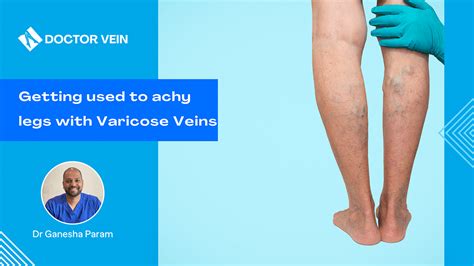 Restless Legs And Varicose Veins Doctor Vein