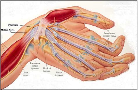 About 75% of patients have a history of preceding infection. El síndrome de Guillain-Barré, síntomas y tratamiento ...