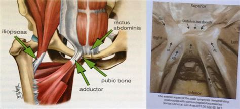 Diagram Of Female Groin Area Review Of Atlas Of Pelvic Anatomy And