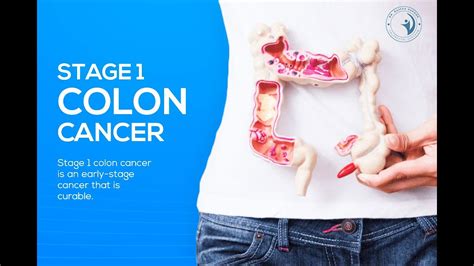Stage 1 Colon Cancer Is An Early Stage Cancer That Is Curable Dr Rajeev Kapoor Youtube
