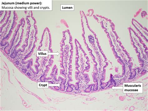 Small Bowel Normal Histology Nus Pathweb Nus Pathweb