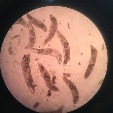 Marine Parasites Little Guys That Make A Big Difference Research Blog