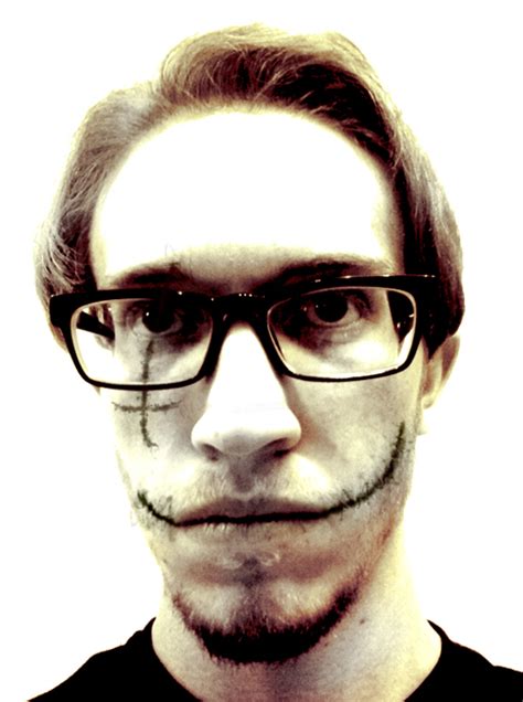 In fiction, the glasgow smile — which is sometimes known as the chelsea smile or the chelsea grin — is most notoriously associated with the joker, the iconic batman villain. Glasgow Smile Artist by Synrako on DeviantArt