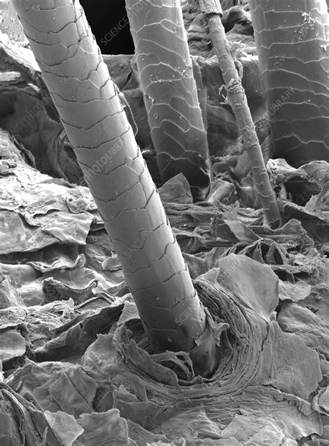 Scanning Electron Microscope Sem Image Of A Human Hair X 500 Stock