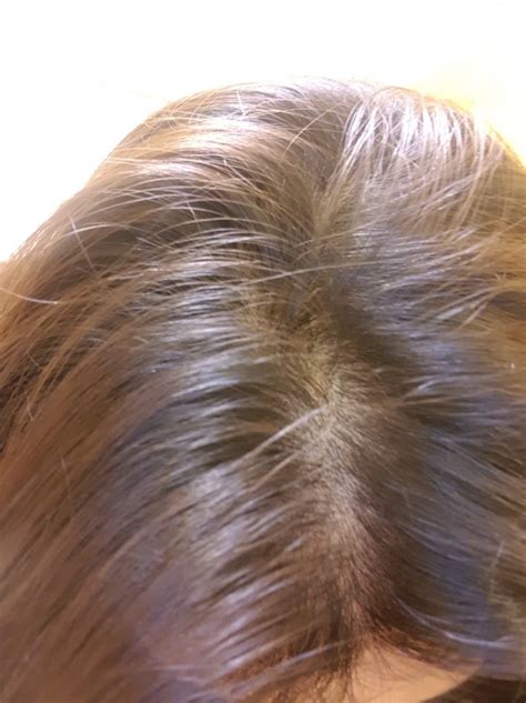 That john frieda one, or similar ones where it's supposed to make blonde hair lighter or nothing is going to happen if you put that on dark hair as your base is darker than the pigment, and the shampoo doesn't contain ingredients that lift the colour. Plantur39 - Plantur 39 Colour Brown Shampoo & Conditioner ...