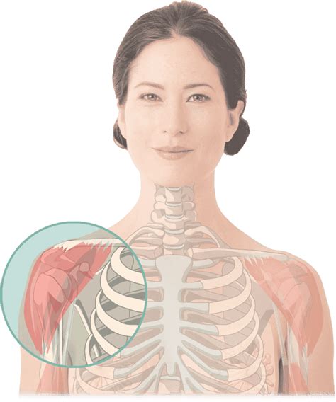 Mrt Schulter Dauer And Ablauf Aristra Radiologie Netzwerk