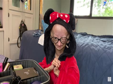 Adalia Rose Williams Death Youtube Star With Benjamin Button Syndrome Dies Aged 15 The