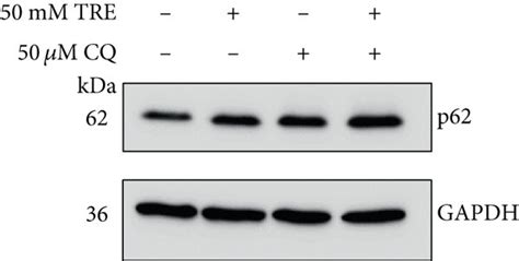 Effect Of Trehalose On P62 Mrna And Protein Expression Levels And P62 Download Scientific